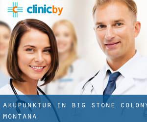 Akupunktur in Big Stone Colony (Montana)