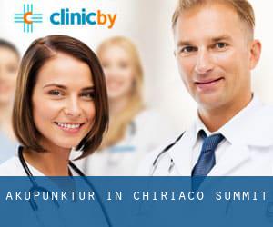 Akupunktur in Chiriaco Summit