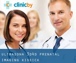 Ultrasona 3D/4D Prenatal Imaging (Kissick)